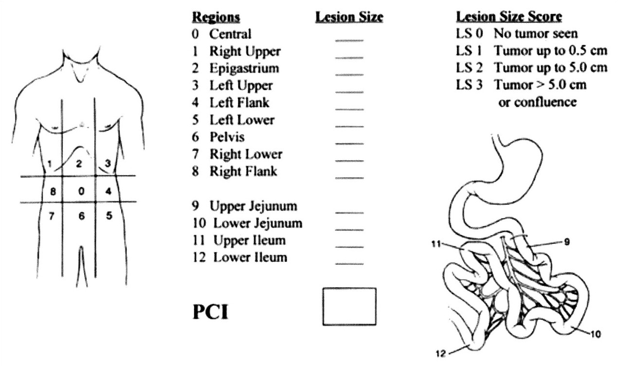 Determining the Peritoneal Cancer Index - HIPEC